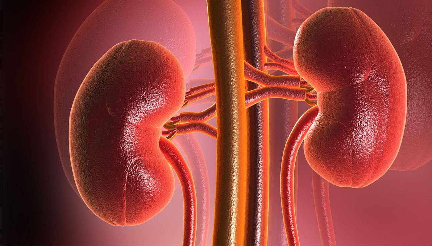 Renal Transplant in Lucknow